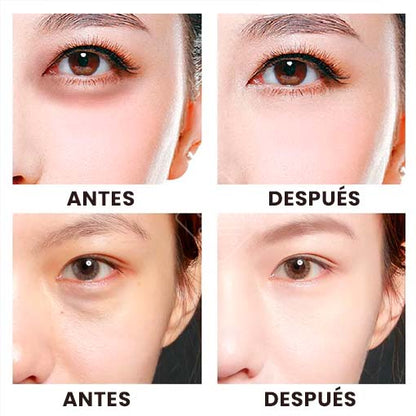 PARCHES HIDROGEL ORIGINAL® | ⭐⭐⭐⭐⭐