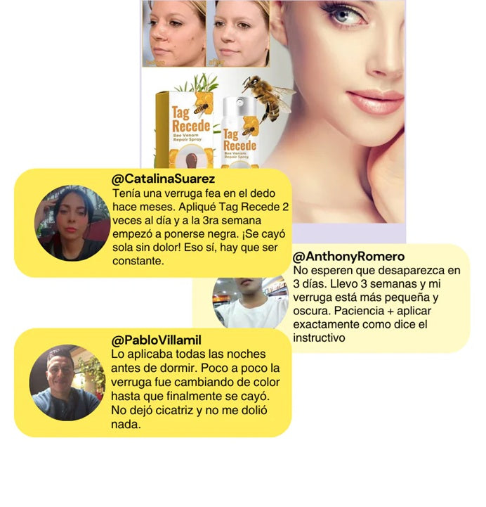 Spray de veneno de abeja TAG RECEDE™