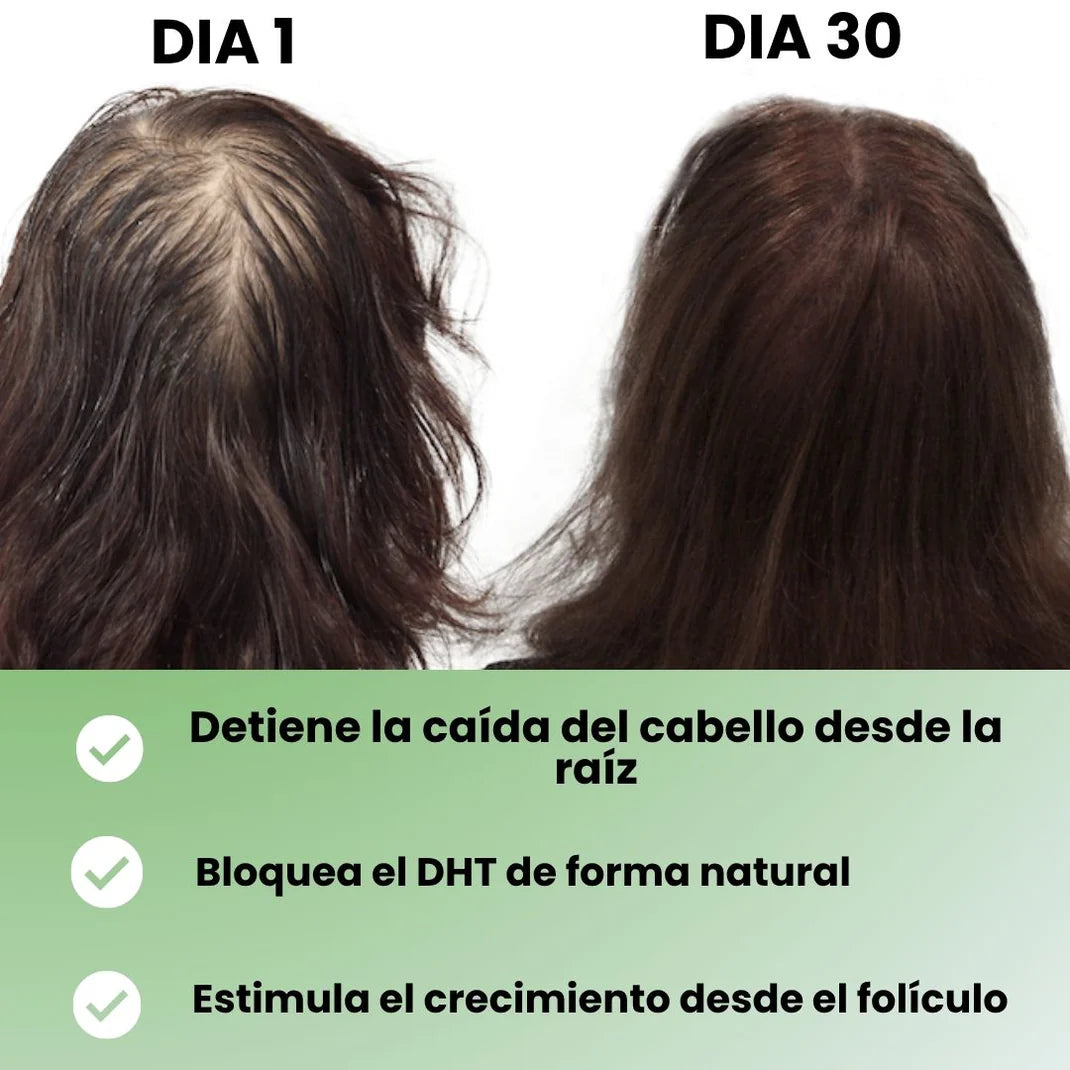 🧴Shampoo Batana Pro™ – Recupera tu cabello