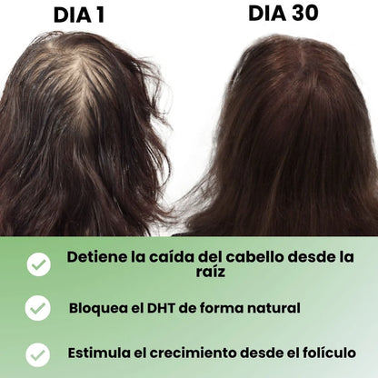 🧴Shampoo Batana Pro™ – Recupera tu cabello